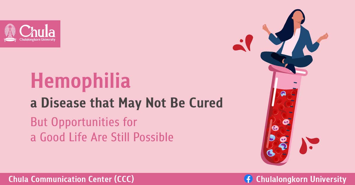 Hemophilia – Opportunities for a Good Life Are Still Possible – Chulalongkorn University