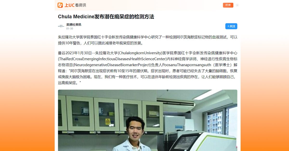 Chula Medicine发布潜在痴呆症的检测方法– Chulalongkorn University