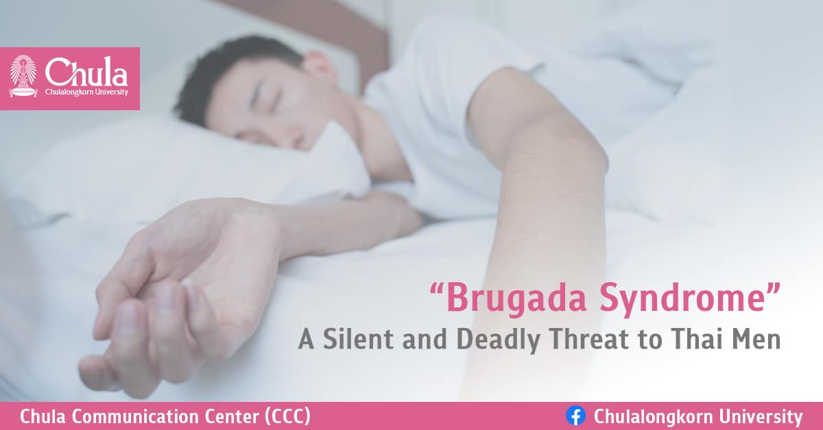 Brugada Syndrome A Silent and Deadly Threat to Thai Men