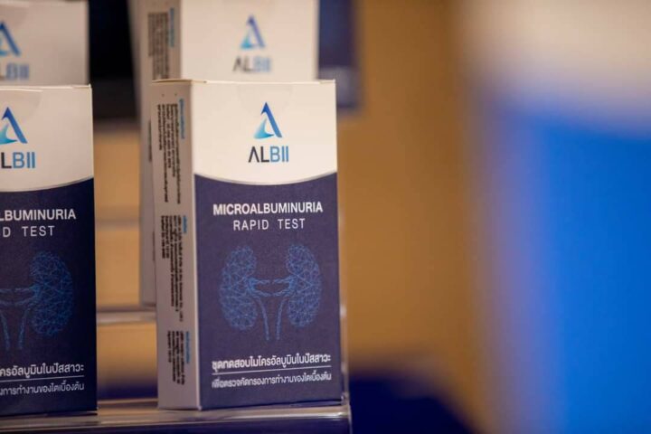 Chulalongkorn Unveils “Microalbuminuria Rapid Test”: Easy, Accurate, Ready for Commercial Use 