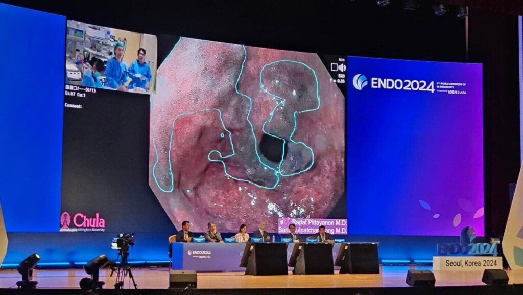 A live transmission of endoscopy using DeepGI at ENDO 2024 