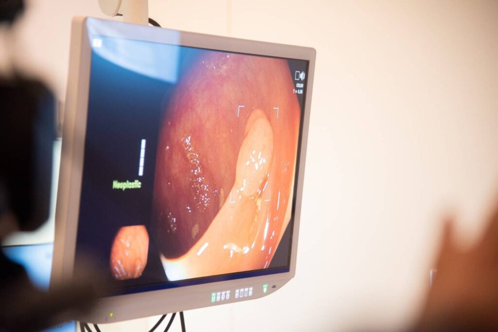 “DeepGI” — AI-Assisted GI Endoscopy for Accurate Colorectal Cancer, a Collaboration between Chulalongkorn’s Engineers and Doctor, Shines at ENDO 2024 in South Korea